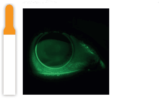 BANDELETTES DE FLUORESCÉINE – Image 2